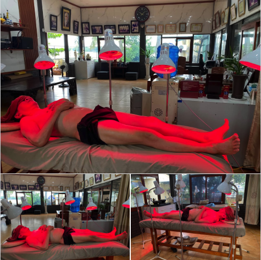 Điều trị hội chứng Xơ cứng bì, co cứng cơ tại Bảo Minh Đường